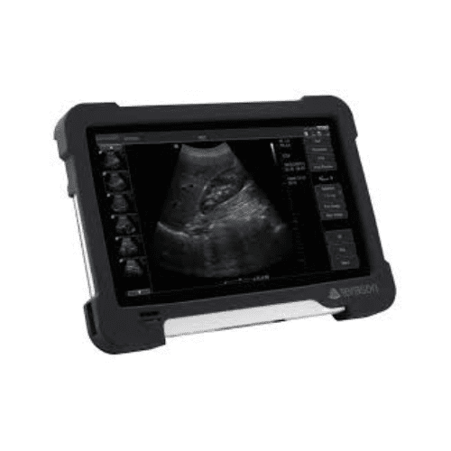 Ecógrafo portátil uSmart 3200T de Terason, tecnología de ultrasonido avanzada para diagnósticos médicos precisos.
