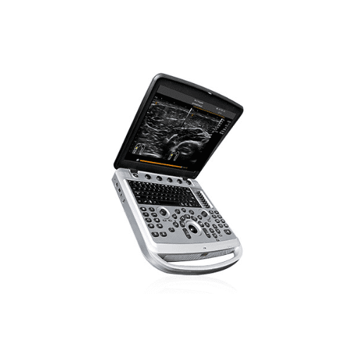 Ecógrafo portátil Chison SonoBook 5 abierto para diagnóstico médico con imágenes de alta calidad.