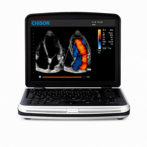 Ecógrafo CHISON SonoBook 7 mostrando imagen Doppler en pantalla